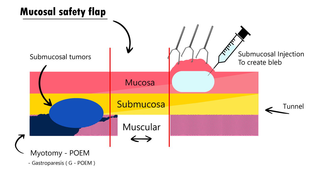 Endoscopic Surgery â€“ An Evolving Interdisciplinary Subspecialty